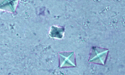 Urinary crystals under a microscope