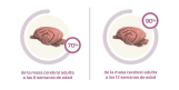 masa cerebral adulta