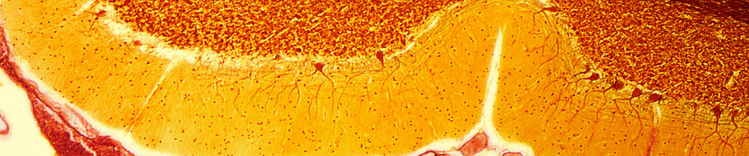 cervello che invecchia