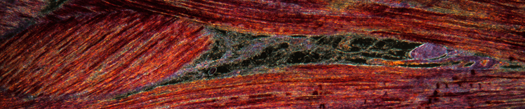 muscle tissue