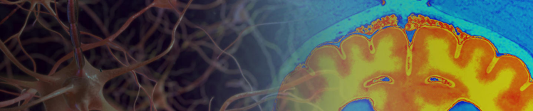 condiciones cerebrales